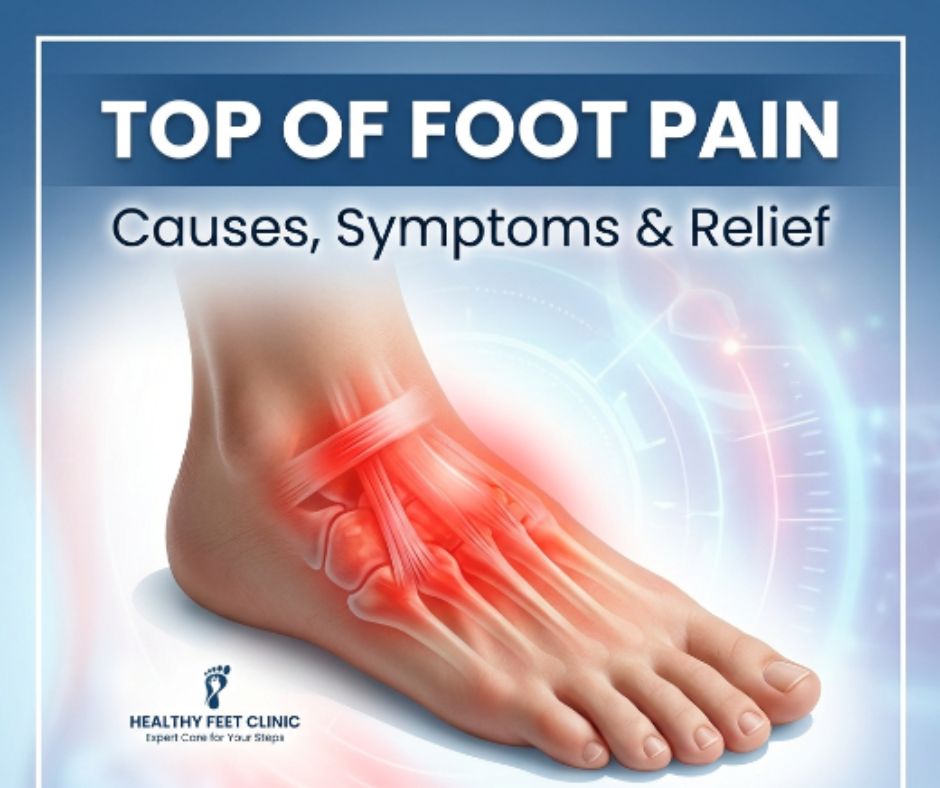 top-of-foot-pain